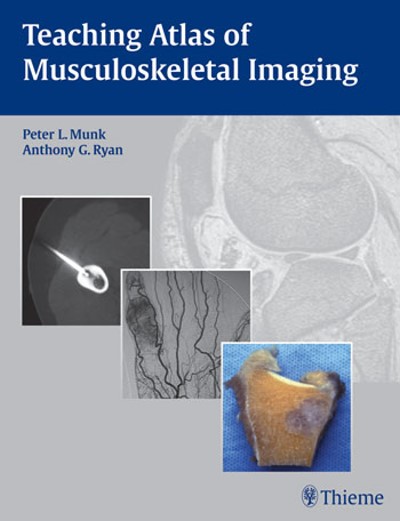 Teaching Atlas of Musculoskeletal Imaging